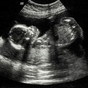 100 pics U Is For answers Ultrasound 